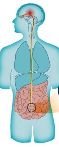 Causes du psoriasis, le système digestif