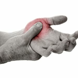 Douleur psoriasis main
